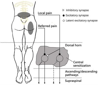 Referred pain: characteristics, possible mechanisms, and clinical management